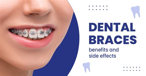 What Makes Magic Teeth Braces Different from Other Orthodontic Options?